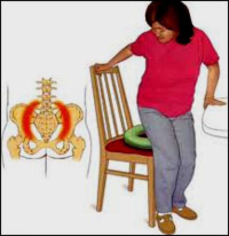 درد دنبالچه یا Coccydynia و درمان آن